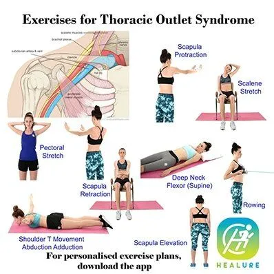 Thoracic Outlet Syndrome Treatment-2